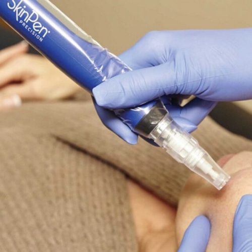 SkinPen Deluxe Microneedling